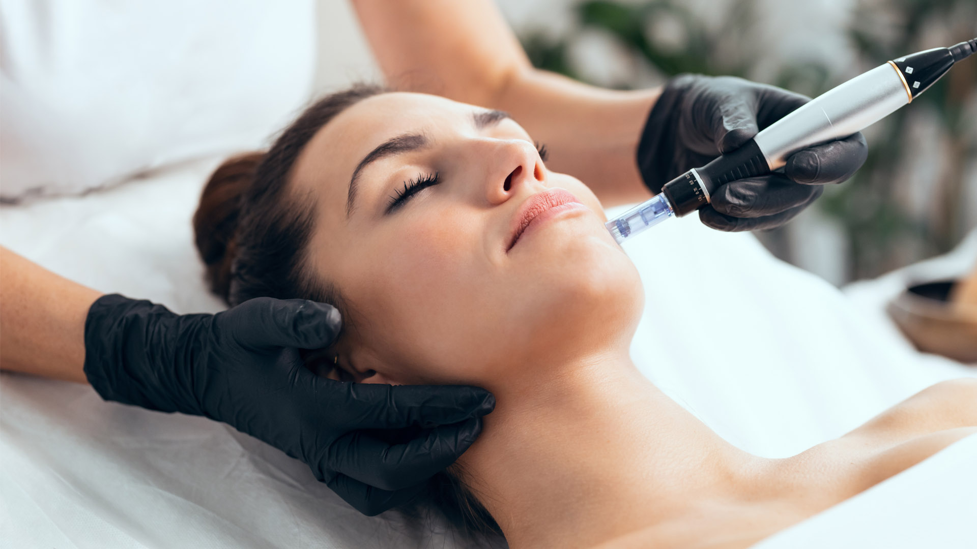 Access Microneedling Treatment Services at The Best Medical Spa in Houston, New You Wellness Center