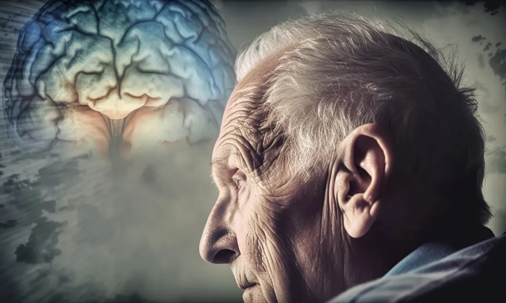 10. The Role of a Neurologist in Stroke Prevention and Recovery