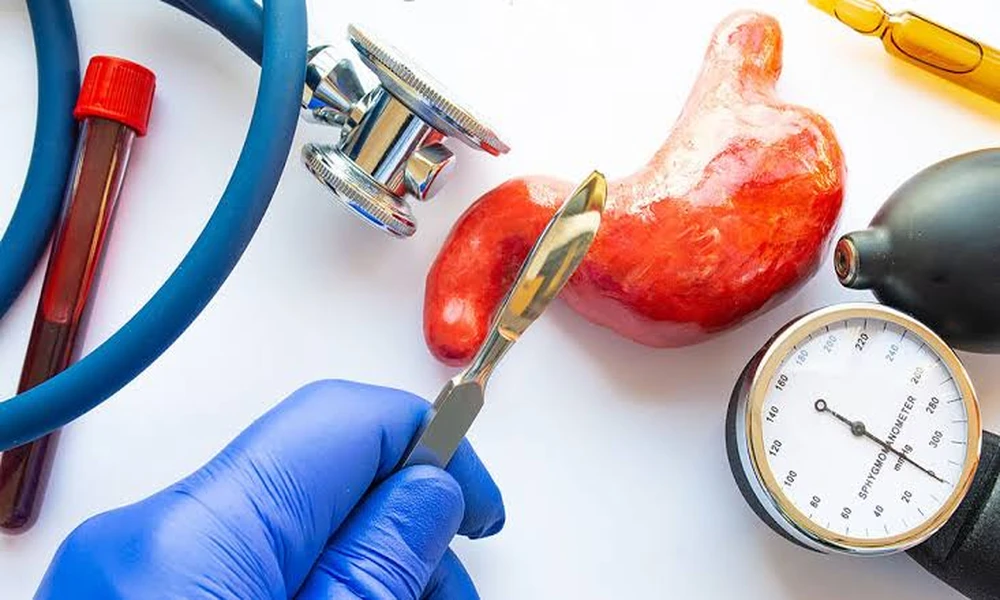 Revision Weight Loss Surgery: Why It’s Needed and Who It Benefits